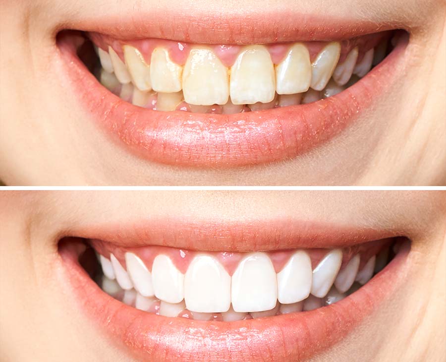 before-after-1